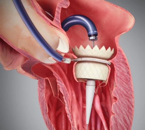 1659324465193746.png 图片.png