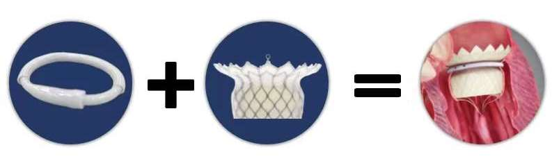 1659325285197839.png 图片4.png